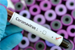 Karnataka: 41 new Covid cases reported